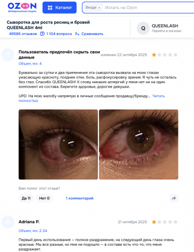 Queenlash отзывы: комедия ошибок и опасность для здоровья